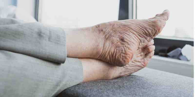 Gratis voetzorg voor Haagse daklozen: ‘Het is fantastisch werk’